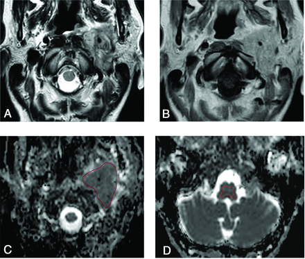 FIG 1.