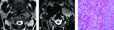 FIG 4.