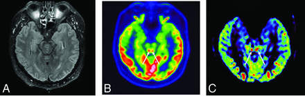 FIG 3.