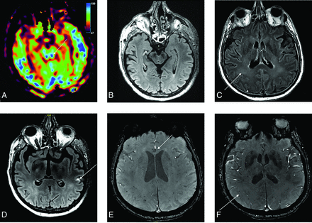FIG 4.