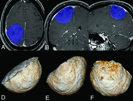 FIG 2.