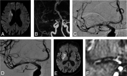 FIG 2.