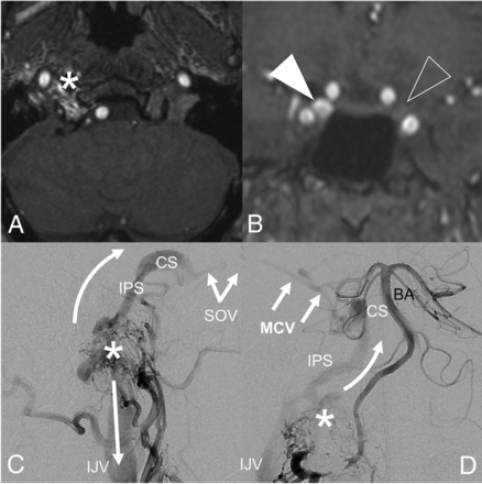FIG 4.