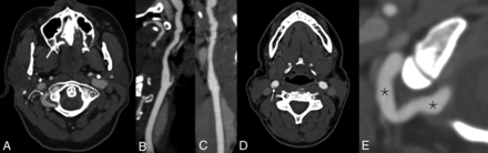 FIG 1.