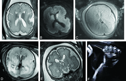 FIG 1.