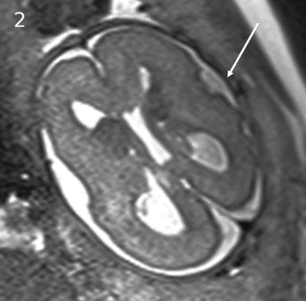 FIG 2.