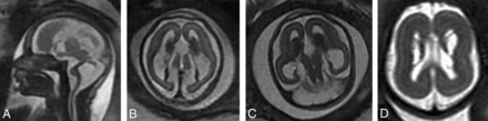 FIG 4.