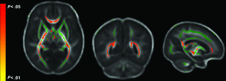 FIG 1.