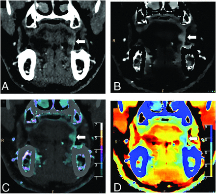 FIG 4.