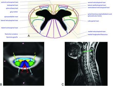 FIG 2.