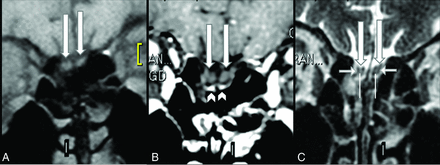 FIG 1.