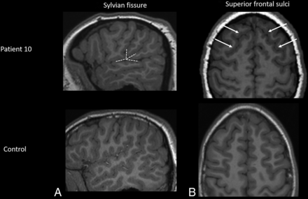 FIG 1.