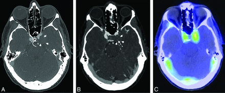 FIG 2.