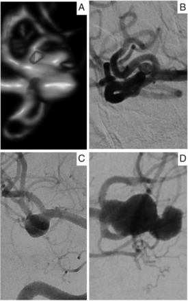FIG 1.