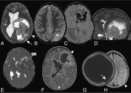 FIG 1.