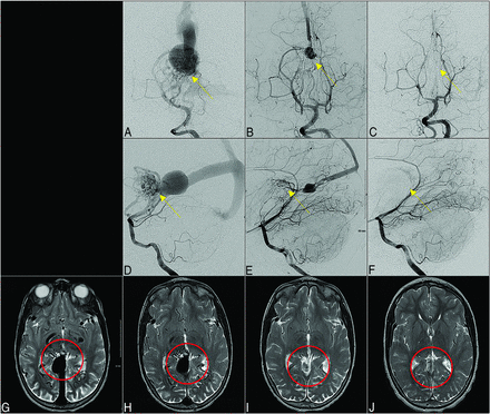 FIG 4.