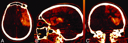 FIG 2.