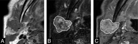 FIG 1.