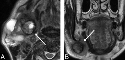 FIG 2.