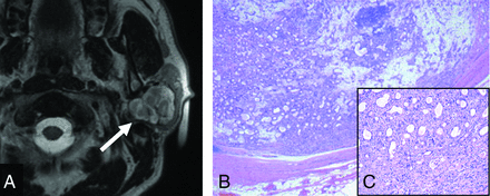 FIG 3.