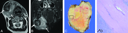 FIG 4.