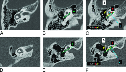 FIG 1.