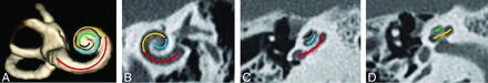 FIG 2.