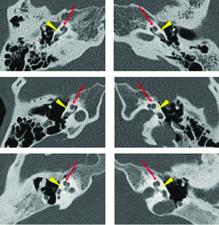 FIG 6.