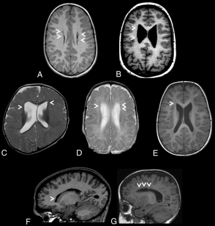 FIG 1.