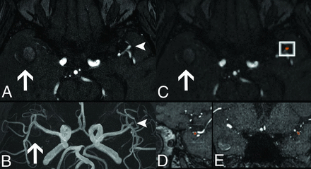 FIG 3.
