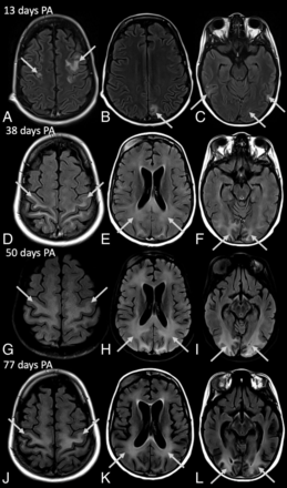 FIG 4.