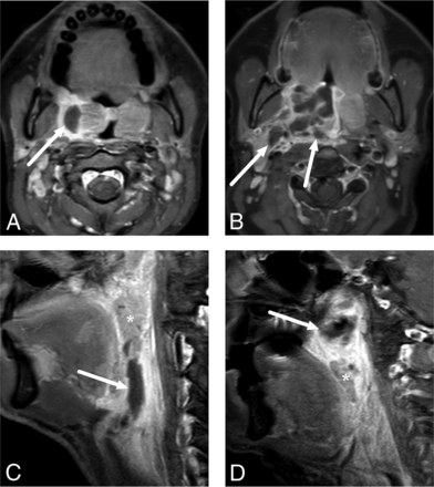 FIG 2.