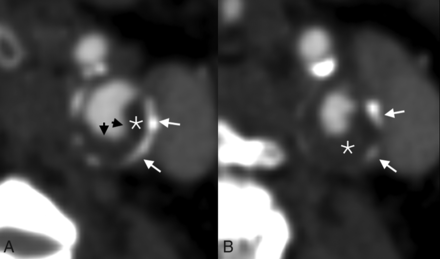 FIG 1.