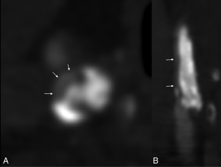 FIG 2.
