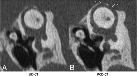 FIG 2.