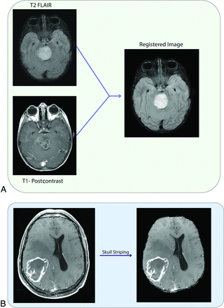 FIG 2.