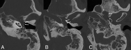 FIG 3.
