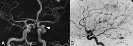 FIG 1.