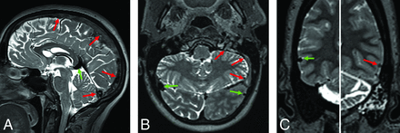 FIG 1.