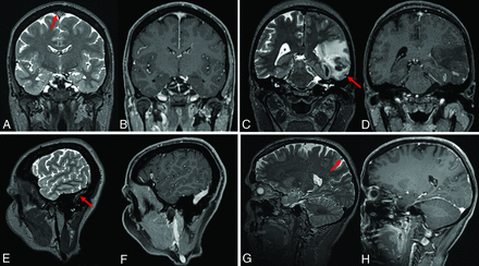 FIG 3.