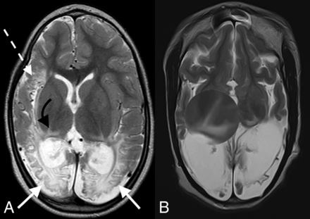 FIG 2.