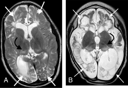 FIG 4.