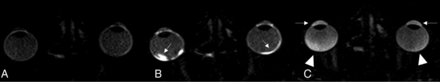 FIG 4.