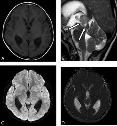 FIG 2.