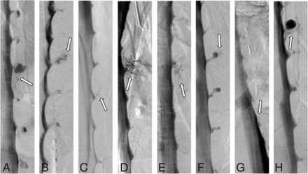 FIG 1.