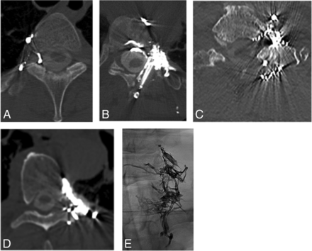 FIG 2.