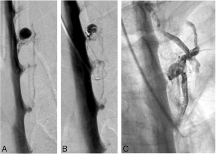 FIG 3.