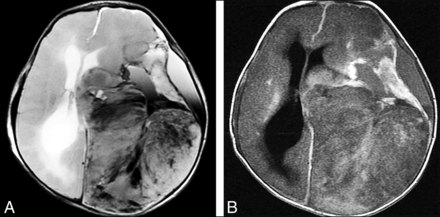 FIG 6.
