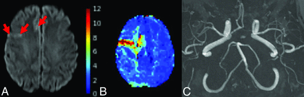 FIG 3.