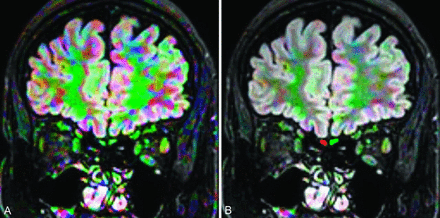FIG 1.